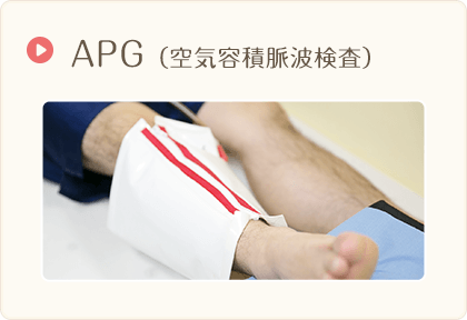 APG（空気容積脈波検査）
